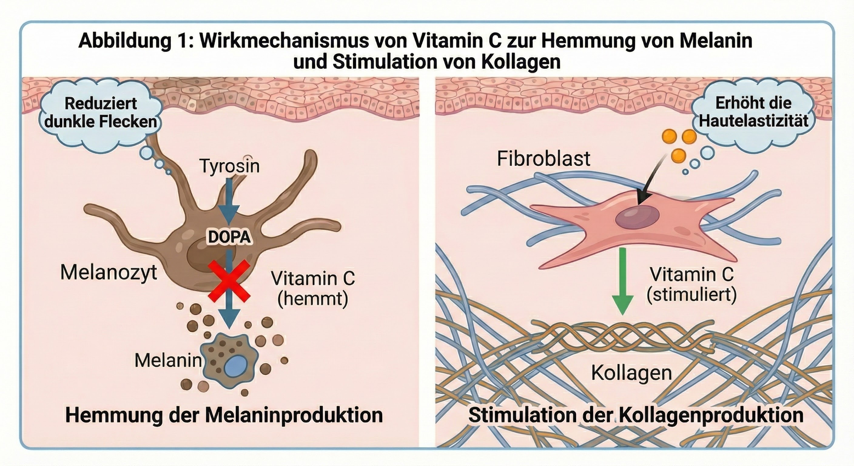 Illustration, die zeigt, wie Vitamin C die Melaninproduktion hemmt